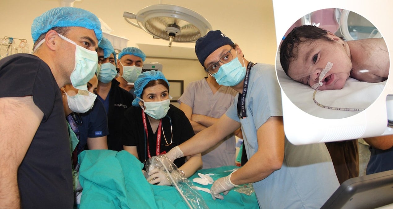 tip-tarihine-gececek-operasyon-3-kilo-bebekten-yarim-kilo-tumor-cikti-Y4J29pYX.jpg